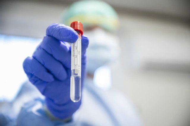 17.11. klo 14.22 Kuopiossa ja Siilinjärvellä palattu koronaepidemian perustasolle